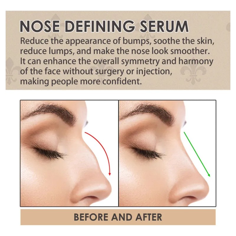 3. Aceite Esencial Para Levantar La Nariz Y Reducir El