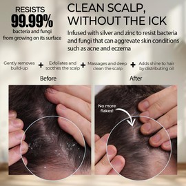 Fiora Naturals Scalp Massager Shampoo Brush - Silicon Scalp Scrubber & Exfoliator for Dandruff Removal and Hair Growth, Brush for Wet & Dry Hair, for Men, Women, Kids - BPA Free