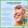 Anti Fungal Skin Cream，Psoriasis and Eczema Soothing Ointment, Dermatitis and