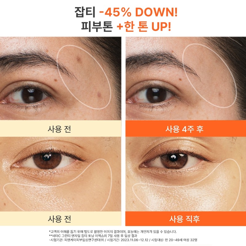 Innisfree [이니스프리]비타C 그린티 엔자임 세럼 기획세트 + 나이아신아마이드닝 아이세럼 10ml