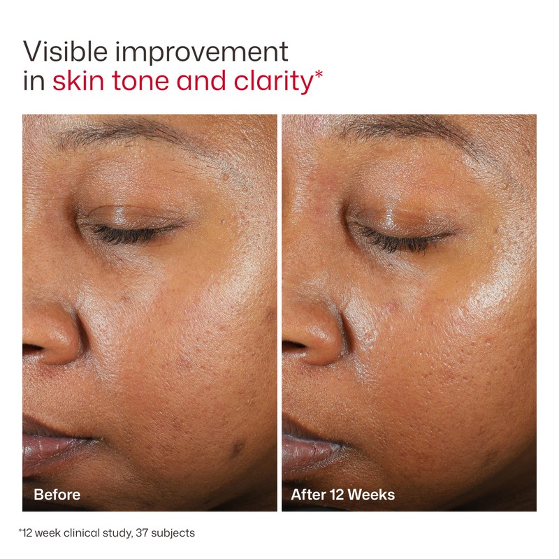 EltaMD UV Clear Face Sunscreen SPF 46, Oil-Free Sunscreen with