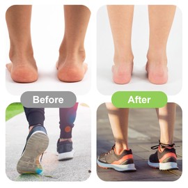 MBAIYO 3 Paar Fußgewölbebandage,Fußgewölbe-Bandagen Verstellbare Mittelfußbandage Kompressions-gepolsterte Plantarfasziitis Bandage zur Linderung von Plantarfasziitis und Fußgewölbeschmerzen