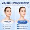 Pack of 5 Collagen Mask, Hydrogel Mask, Moisturising Mask for