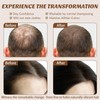 Natural Instant Hair Fibres Thickening with Keratin，Hair Filler-Bald Patch Cover