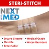 NEXT LEVEL MED Steri-Stitch Wounds & Cuts Closure Kit -