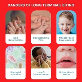 CONTROL-IT Solución Natural Para Morderse Las Uñas Y Chuparse El Dedo | Repelente Natural 100% Natural Para El Sabor Amargo, Seguro Para Niños | Suave
