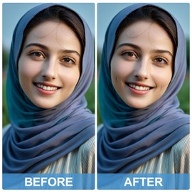 HINZIC 2PCS Natural Dimple Makers, Black Facial Muscle Dimple Trainer Exerciser Lift Tools for Beautiful Smile