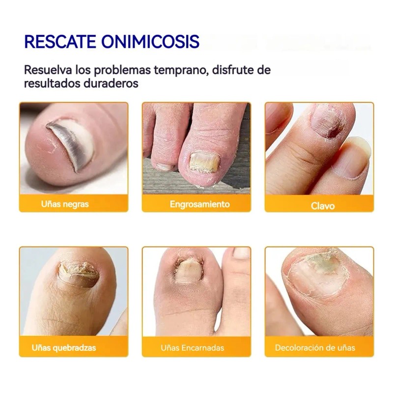 Parches Antimicóticos For El Tratamiento De Uñas