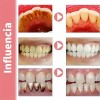 Pasta Dental Blanqueadora Probiotica Sp-8 120g X3