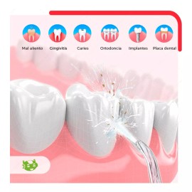 Slim Company Irrigador Bucal Dental Portatil Recargable Limpiador Chorro Color Rosa Ky06