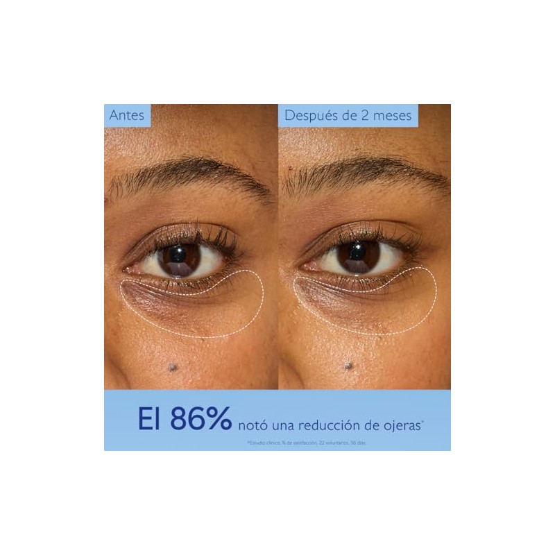 Caudalie Vinoperfect Contorno de Ojos Iluminador con Nicinamida - 15