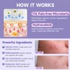 36-Count Microdart Acne Patches, Cute Round-shaped microdart pimple patch