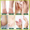 Cracked Foot Cream Roll-On Moisturizer, 1.76floz