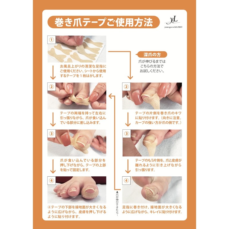 (Professional Supervision of Winding Nail Management) Easy to Apply! Winding