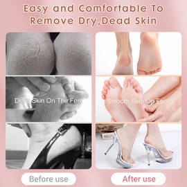 Electric Foot File Callus Remover for Feet, Professional Tool for Dead Skin with 60 pcs Replacement Sandpaper Disk for Men Women Adjustable Speed Controller with Aluminum Callus Remover