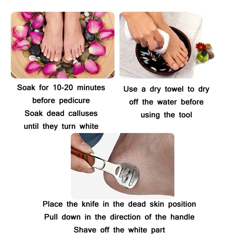 Stainless Steel Callus Remover with Wood Effect with 10 Replacement