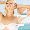 Sielkin Shave Razor Bump Ingrown Hair Aftershave: Treatment Lotion for