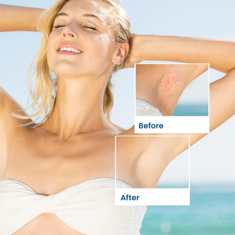 Sielkin Shave Razor Bump Ingrown Hair Aftershave: Treatment Lotion for