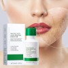 Serum Liquido Antiacne Reparador Espinillas Acido Salicilico