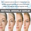 2pcs Retinol Serum Gesicht, Straffende Seren, Erfrischende Gesichtsessenz, Gesichtsstraffende Essenz,