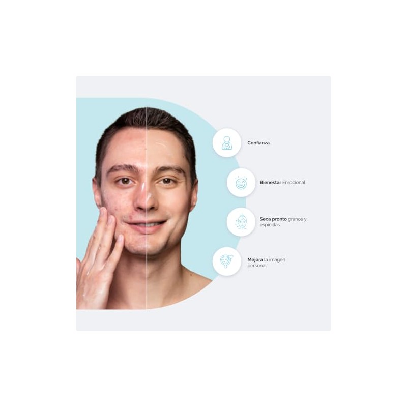 BPO LLEN - BPOllen Gel Peróxido de Benzoilo 2.5% 30