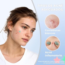 Parches para Acne,400 Almohadillas Hidrocoloides para Espinillas,Pimple Patch,Parches hidrocoloides absorbentes para tratar la erupción de acné y espinillas para el cuidado de la piel. (A, unidad, 400)