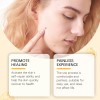 Cuidado De La Piel Smart Buy South Moon Propolis