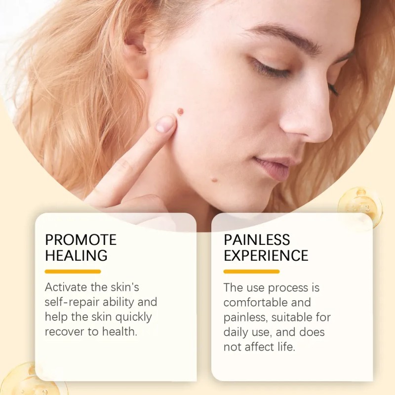 Cuidado De La Piel Smart Buy South Moon Propolis
