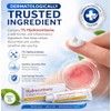 Hydrocortisone Cream 1% w/w Bite and Sting Cream, Mosquito and