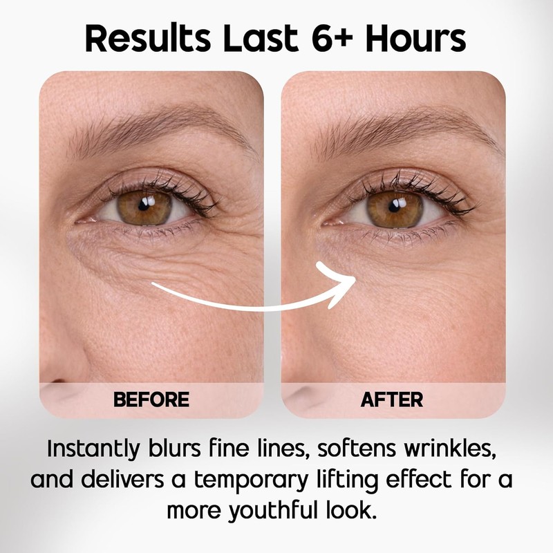 Celestolite Estrella Anti-Wrinkle Syringe