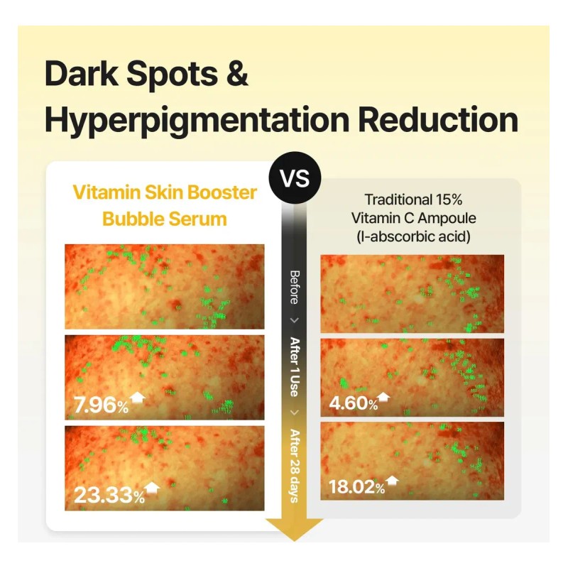 ~! L * Sérum De Vitamina C Meditherapy Para Rostro