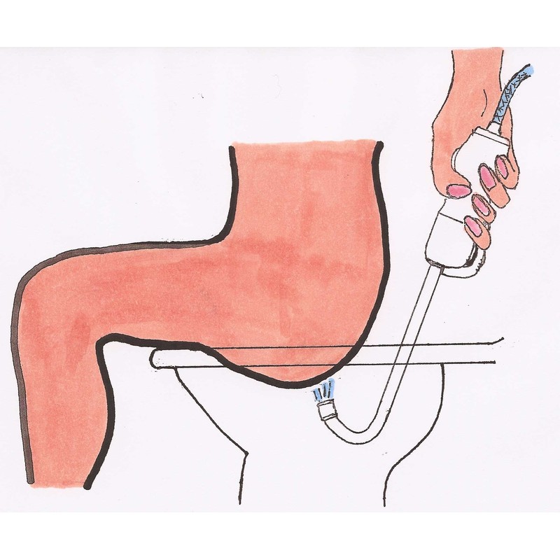 HydraWand Handheld Bidet w/Faucet Diverter, Ergonomic Wave-Form Handle, &"J" Nozzle,