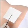 Alcare Delmaide 2.0 x 2.0 inches (50 x 50 mm)