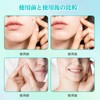 spot patch, spot patch, point patch, sensitive skin