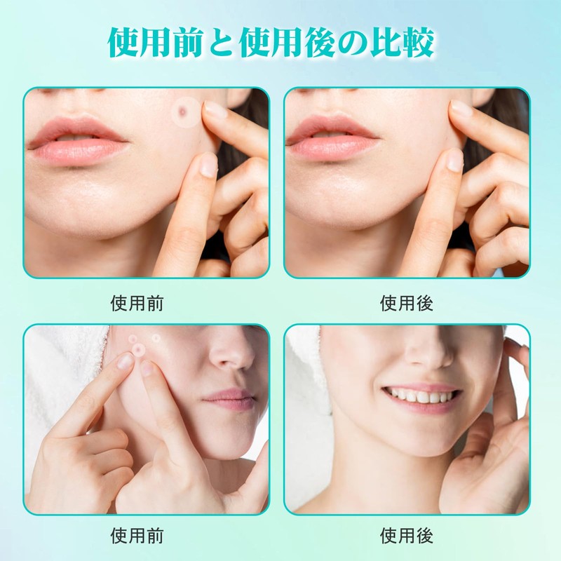spot patch, spot patch, point patch, sensitive skin