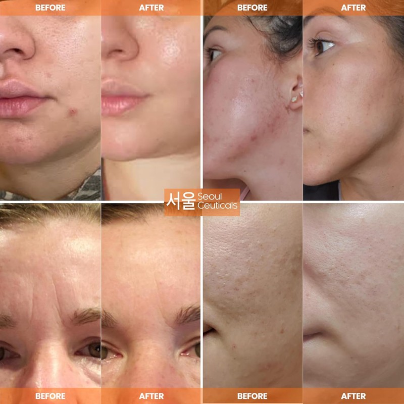 SeoulCeuticals Crema Multiusos con Extracto de Caracol, Vitamina E y