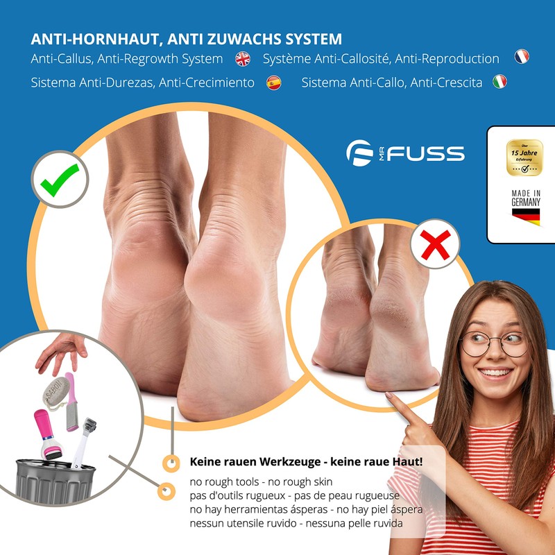 Mr. Fuss® Anti-Callus System - Cuticle Remover - Solution No.