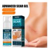 Crema Para Cicatrices En Gel Queloid Acne Removal Treatment,
