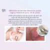 2in1 Vacuum Microdermabrasion Blackhead Acne Removal Beauty