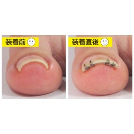 JPS ML4SF Makisame Lift (With File Files), 1 Piece