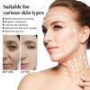 Pemarlis InstaLift Protein Thread Lifting Set, Absorbable Collagen Thread, Soluble