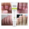 2gel, Antimicótico Para Uñas, Ephamus, Tratamiento Eficaz