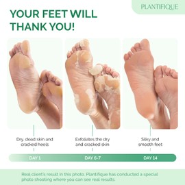 Plantifique Foot Peel Mask – 1 Pair Exfoliating & Dermatologically Tested Foot Treatment, Removes Dead Skin & Repairs Heels for Soft Feet – Peach Scent, Gift for Women & Men
