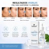 Icetotol - Suero Facial Niacinamida 10% Zinc PCA 1% Icetotol