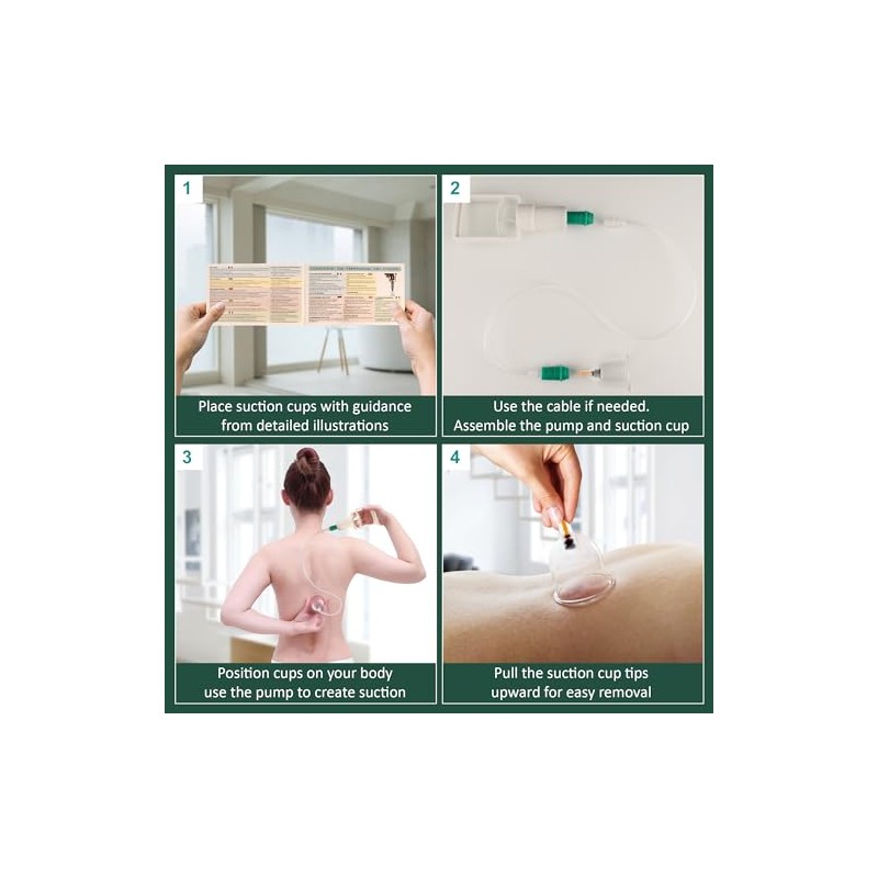 Uplife Uplife Chinese Cupping Therapy Set, 12 Vacuum Air Suction