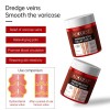Varicose Veins Relief