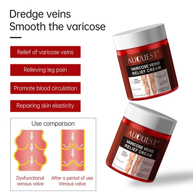 Varicose Veins Relief