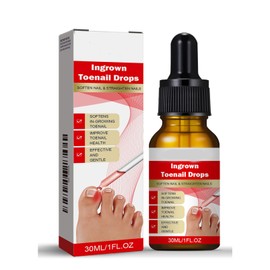 Nail Repair Essence,Fungel Nail Treatmet, Extra Strong Nail Fungas Treatmet for Toenail & Nail, Nourishing, Repairing Toenail,Nail Repair for Thick Nails, Cracked Nails, Damage Nails, 30ml