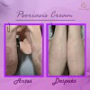 Pack 3 Cremas Facial Corporal Psoriasis Hidratante Aliviante
