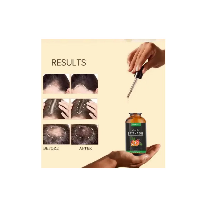 Aceite De Batana For El Crecimiento Del Cabello Con 1pcs